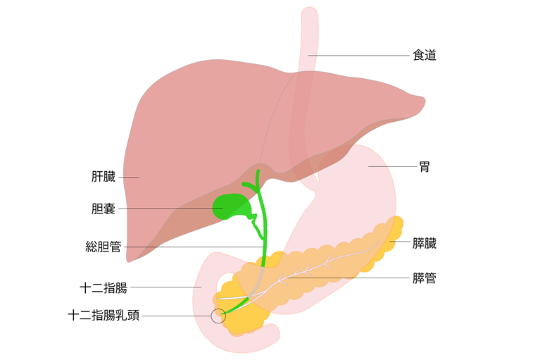 胆石・胆石症とは